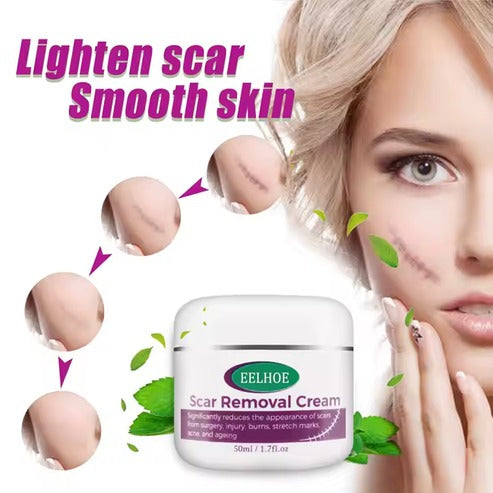 Scar Removal Cream 100 Natural
