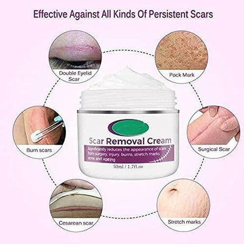 Scar Removal Cream 100 Natural