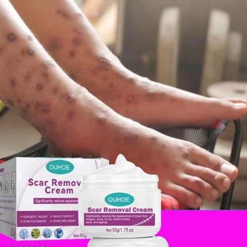 Scar Removal Cream 100 Natural