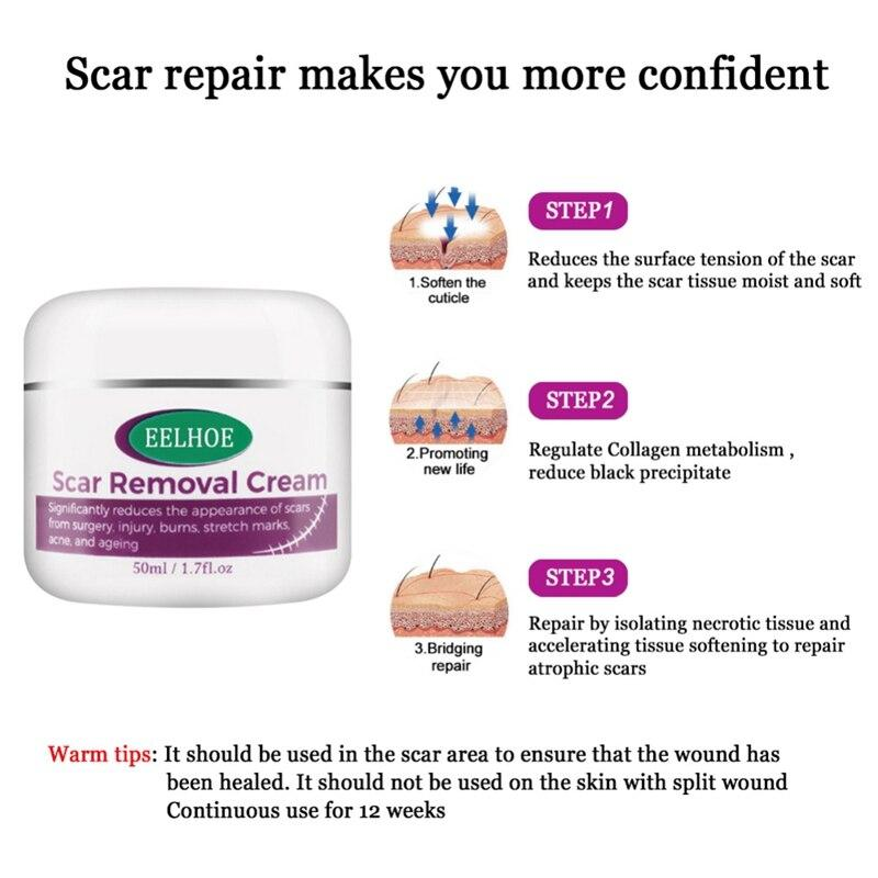 Scar Removal Cream 100% Guarantee