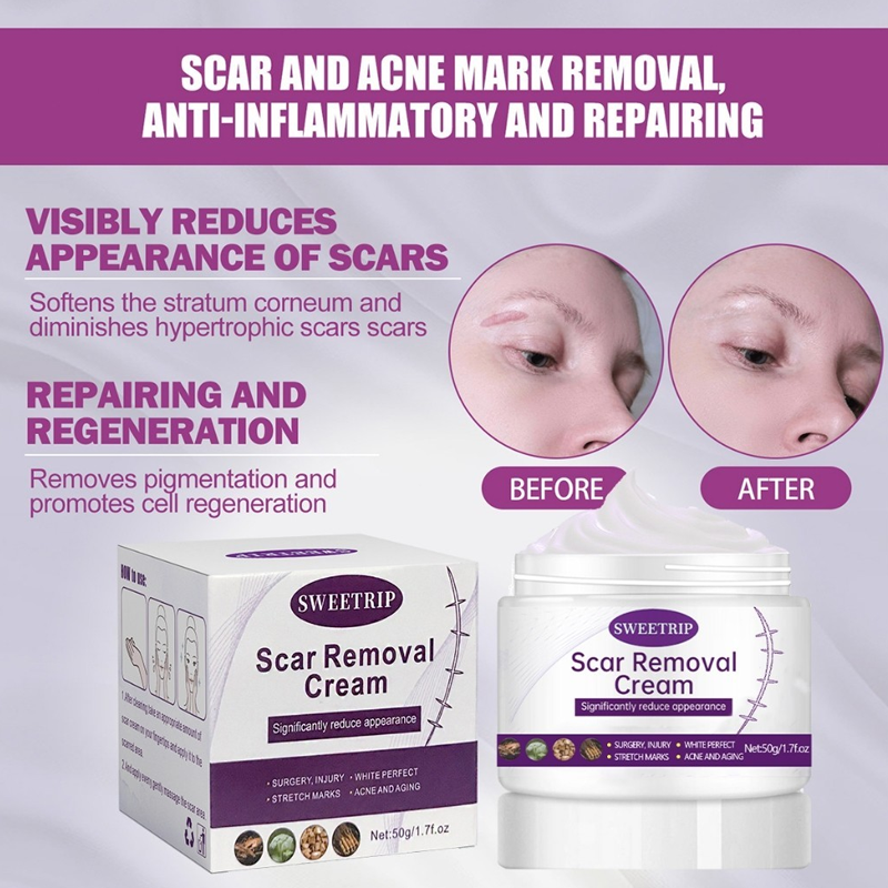 Scar Removal Cream 100% Guarantee