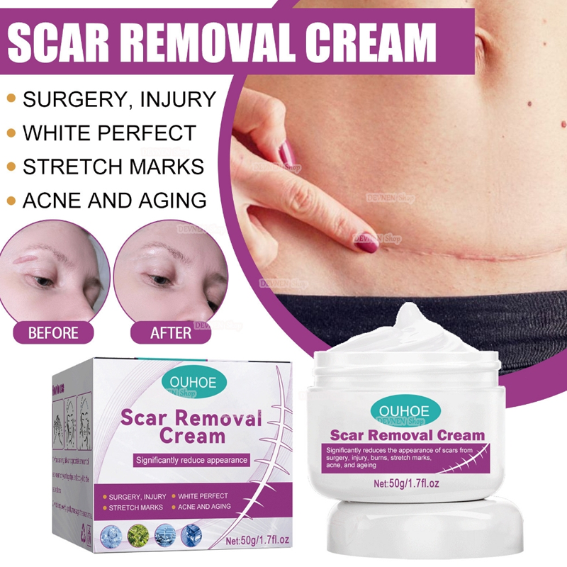 Scar Removal Cream 100% Guarantee