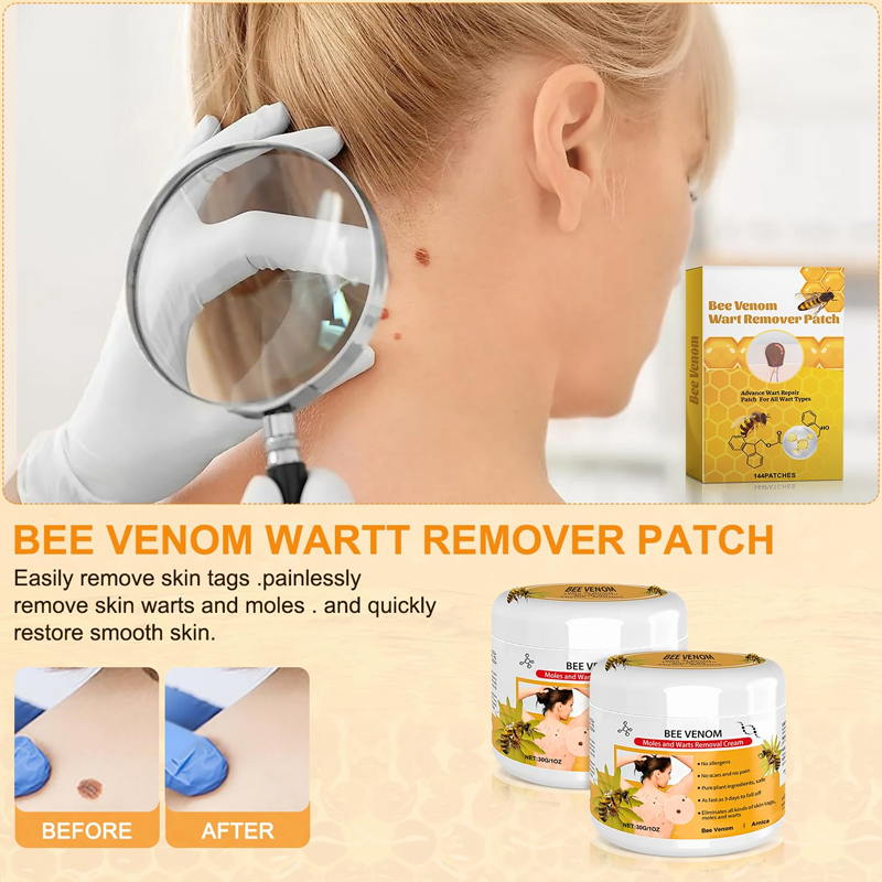 Warts Removal Cream 100% Guarantee