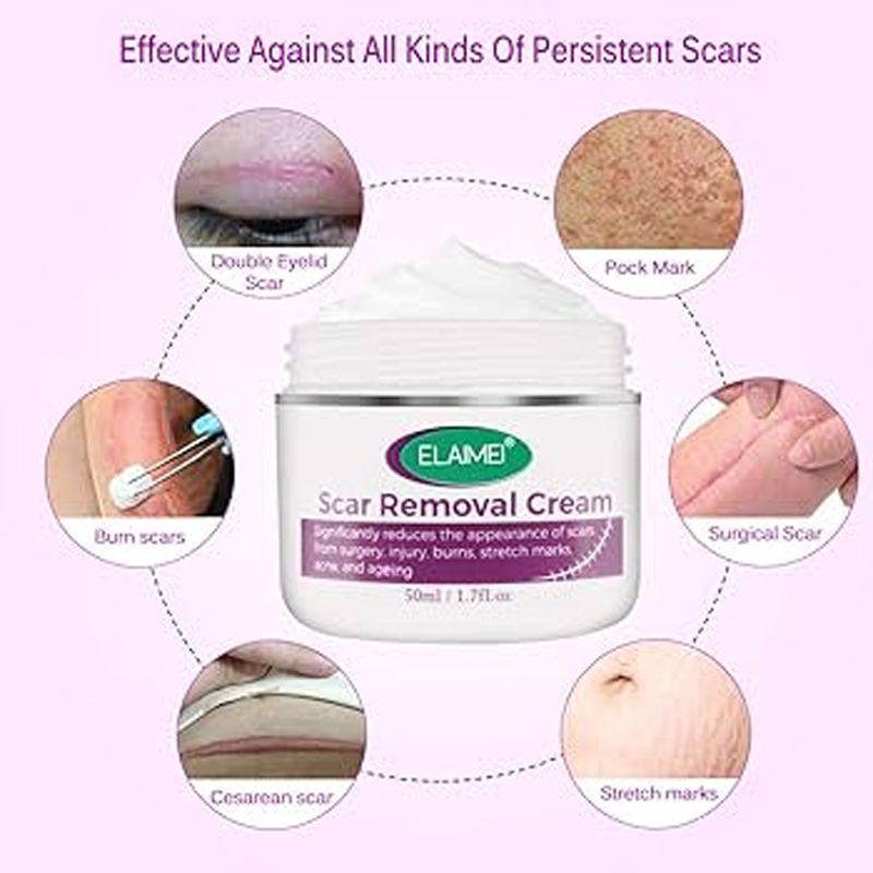 Scar Removal Cream 100% Guarantee