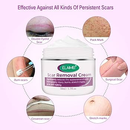 Scar Removal Cream 100% Guarantee