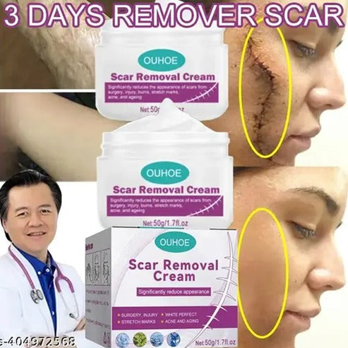 Scar Removal Cream 100 Natural